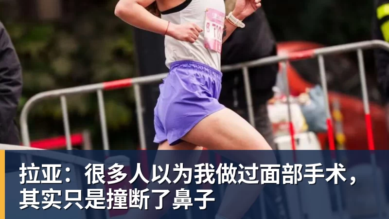 拉亚:很多人以为我做过面部手术,其实只是撞断了鼻子